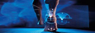 Un estudio biomecánico puede evitar lesiones en los “runners”